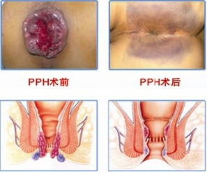 ����Ѫ �ʺ� ��������ô����