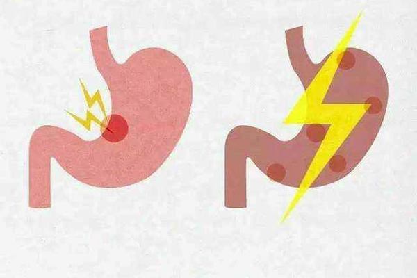 θ���������ٴ�������ʲô�����ݶ���ҽԺƭ����  