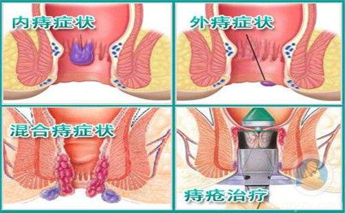 ���ݶ���س�ҽԺƭ���� ����̻��ߵ���ʳԭ���˽�һ��